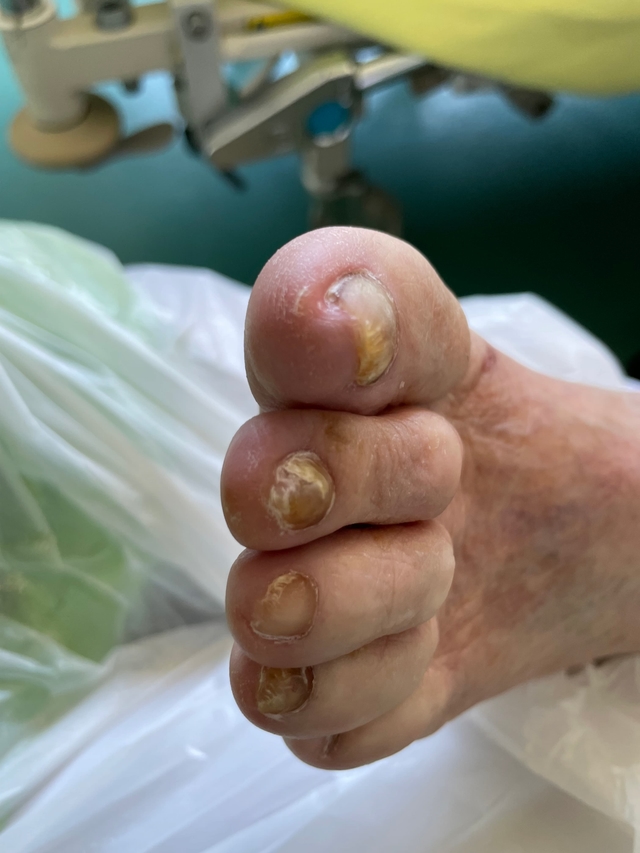soin pedicure après