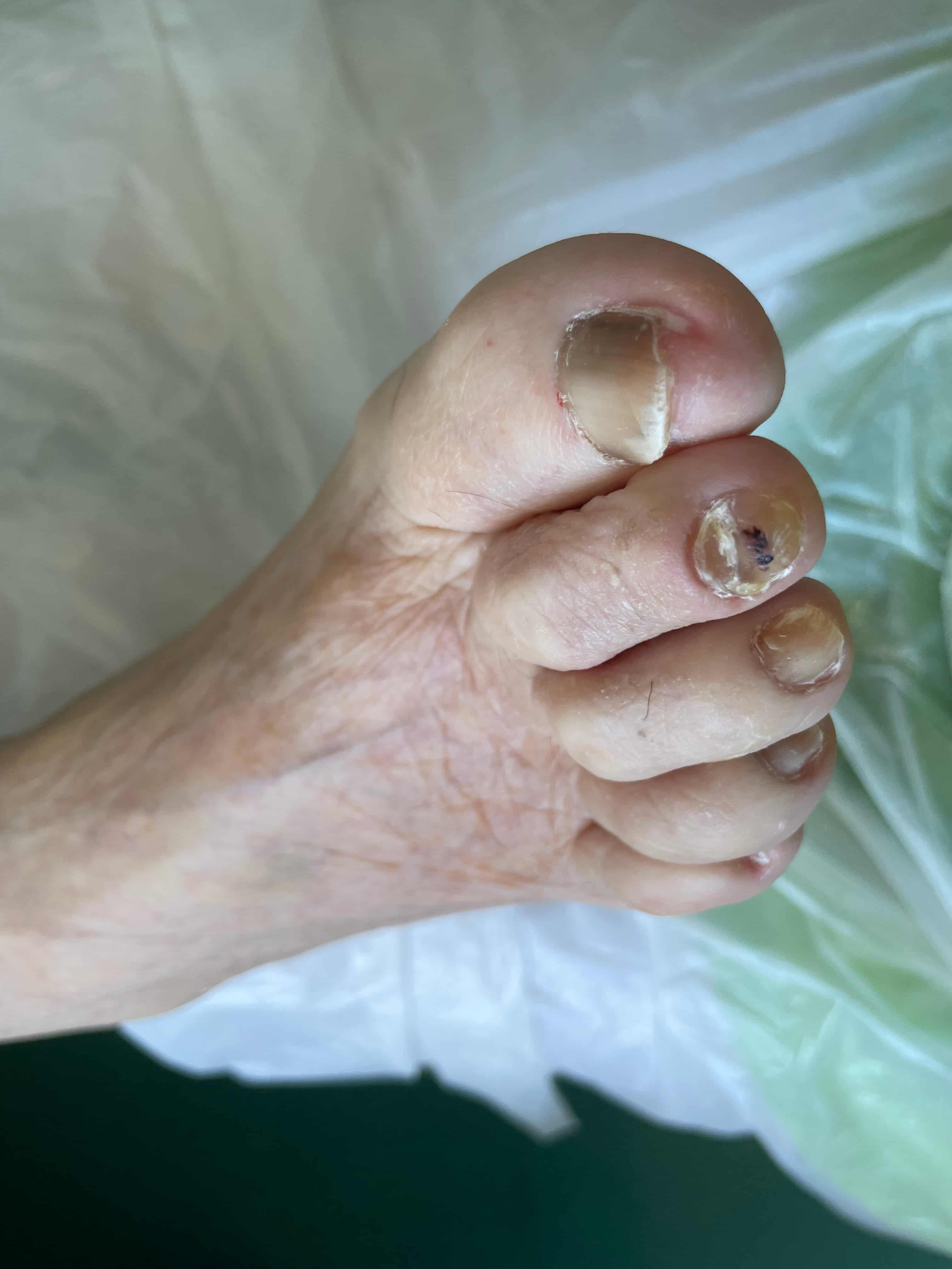 soin pedicure après