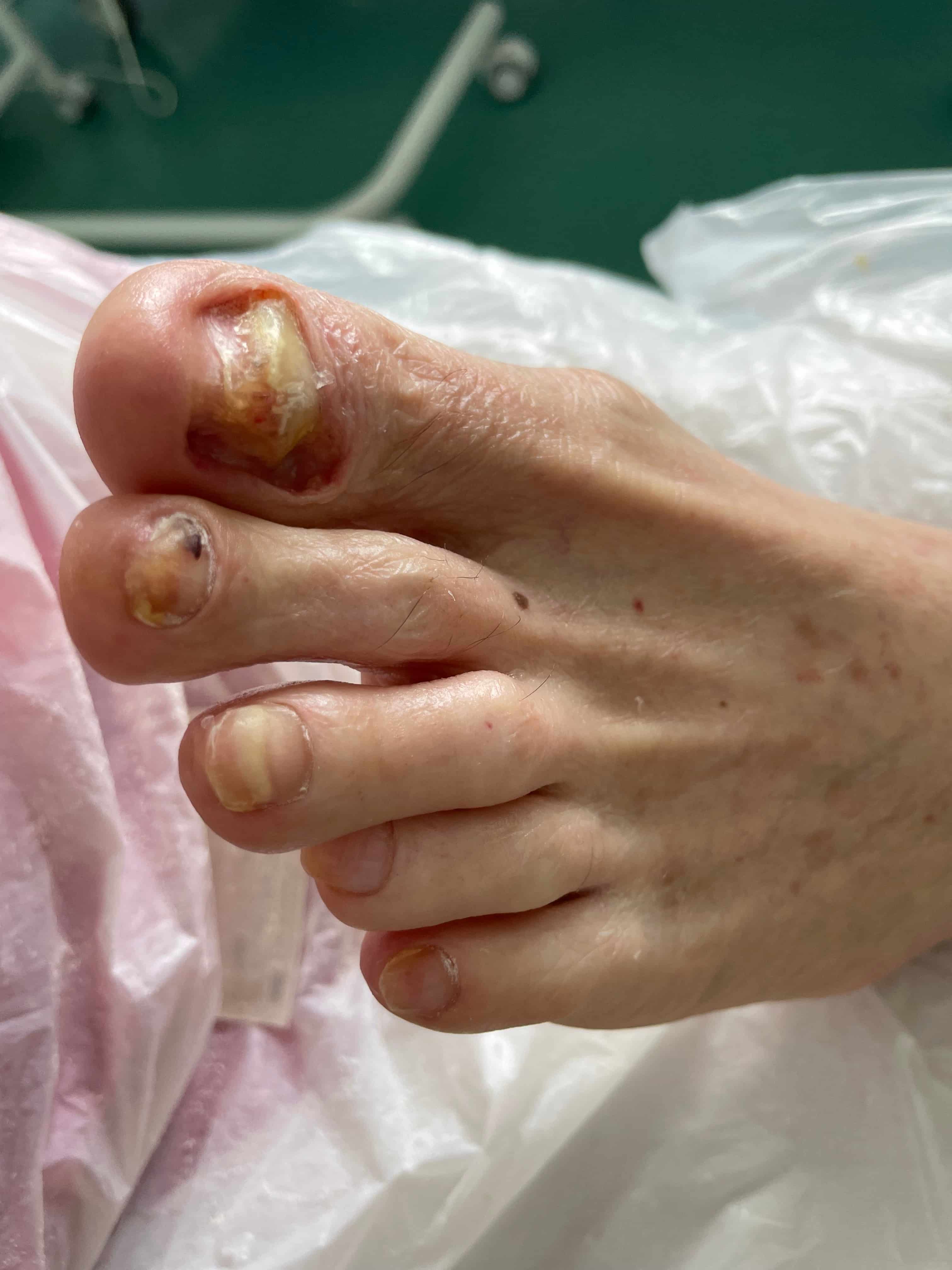 soin pedicure après